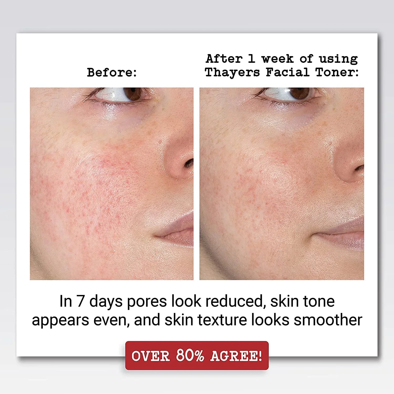 '- 12 (Pack of Fl With Oz - Aloe Witch 2 Vera Hazel 2) Thayers Lavender
