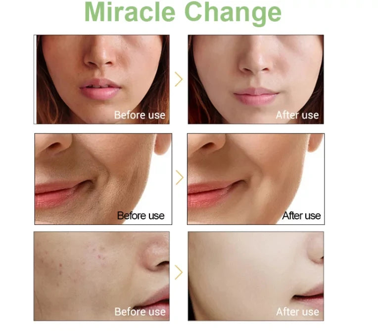And 2.5% Anti Retinol Reducing Aging Serum Wrinkle